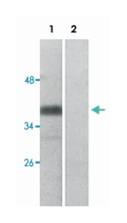 MAP2K3 (phospho T222), Rabbit anti-Human, Mouse, Rat, Polyclonal Antibody, Abnova 100 &mu;L | Buy Online | Abnova Corporation | Fisher Scientific