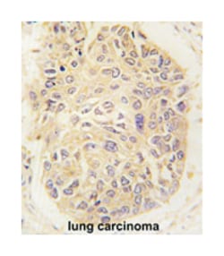 FARSA, Rabbit, Polyclonal Antibody, Abnova 400 &mu;L | Buy Online | Abnova Corporation | Fisher Scientific