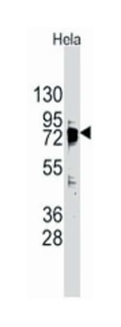 DDX3X Rabbit anti-Human, Polyclonal Antibody, Abnova 400&mu;L; Unlabeled:Anticuerpos
