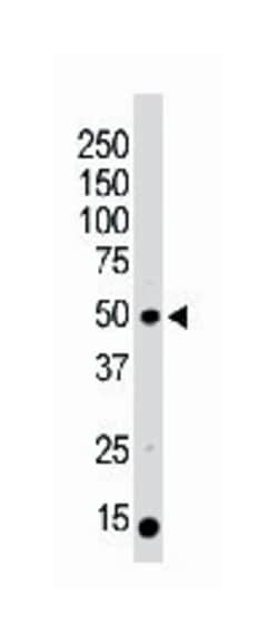 PACSIN3, Rabbit, Polyclonal Antibody, Abnova 400 &mu;L | Buy Online | Abnova | Fisher Scientific