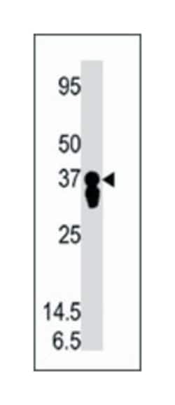 PPP2CA Rabbit anti-Human, Polyclonal Antibody, Abnova 400 &mu;L | Buy Online | Abnova Corporation | Fisher Scientific