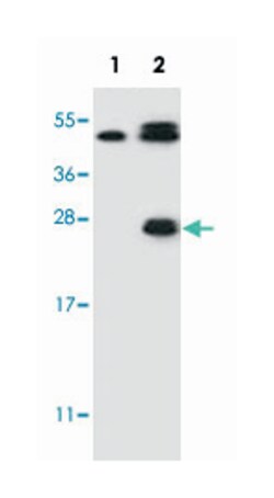 KLK6 Rabbit anti-Human, Polyclonal Antibody, Abnova 400 &mu;L | Buy Online | Abnova Corporation | Fisher Scientific