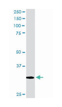 PITPNA, Goat, Polyclonal Antibody, Abnova 100 &mu;g | Buy Online | Abnova Corporation | Fisher Scientific