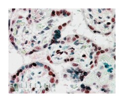 CBX1, Goat, Polyclonal Antibody, Abnova 100 &mu;g | Buy Online | Abnova Corporation | Fisher Scientific