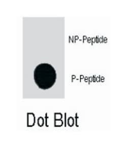 RAF1 (phospho Y340), Rabbit anti-Human, Polyclonal Antibody, Abnova 400&mu;L;