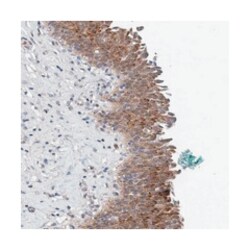 PFAS Rabbit anti-Human, Polyclonal Antibody, Abnova 100 &mu;L | Buy Online | Abnova Corporation | Fisher Scientific