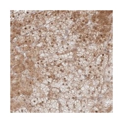 TTC22, Rabbit, Polyclonal Antibody, Abnova 100&mu;L; Unlabeled:Antibodies,