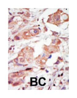 MAP3K10, Rabbit, Polyclonal Antibody, Abnova 400 &mu;L | Buy Online | Abnova | Fisher Scientific