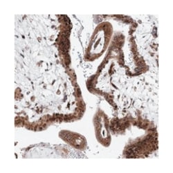 ARHGAP31, Rabbit, Polyclonal Antibody, Abnova 100&mu;L; Unlabeled:Antibodies,