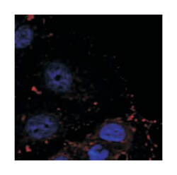 PXN (phospho Y88), Rabbit anti-Human, Polyclonal Antibody, Abnova 100 &mu;g | Buy Online | Abnova | Fisher Scientific