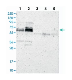 ZNF135, Rabbit, Polyclonal Antibody, Abnova 100&mu;L; Unlabeled:Antibodies,