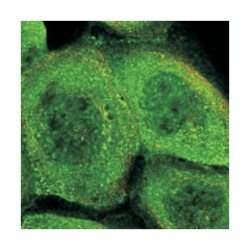 PHLDB3, Rabbit, Polyclonal Antibody, Abnova 100&mu;L; Unlabeled:Antibodies,