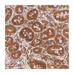 ASCC2, Rabbit, Polyclonal Antibody, Abnova 100&mu;L; Unlabeled:Antibodies,