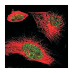 HNF1B, Rabbit, Polyclonal Antibody, Abnova 100&mu;L; Unlabeled:Antibodies,