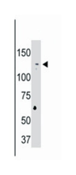 USP25 Rabbit anti-Human, Rat, Polyclonal Antibody, Abnova 400 &mu;L | Buy Online | Abnova Corporation | Fisher Scientific
