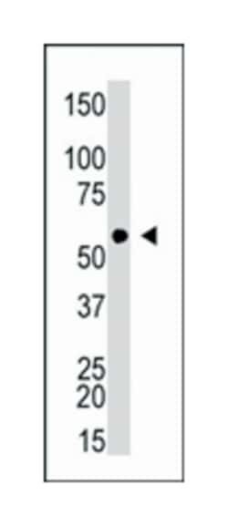 FASTK, Rabbit, Polyclonal Antibody, Abnova 400 &mu;L | Buy Online | Abnova Corporation | Fisher Scientific