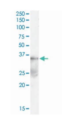 DAZL, Goat, Polyclonal Antibody, Abnova 100 &mu;g | Buy Online | Abnova Corporation | Fisher Scientific