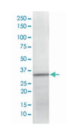 CDC2, Rabbit, Clone: SP80, Abnova 100&mu;L; Unlabeled:Antibodies, Monoclonal
