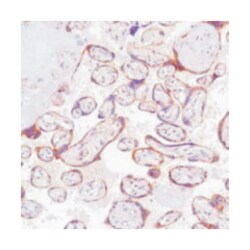 GPC3, Rabbit, Clone: SP86, Abnova 100&mu;L; Unlabeled:Antibodies, Monoclonal