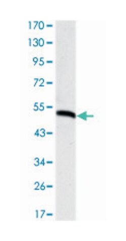 PODXL, Mouse, Clone: 5F5, Abnova 100&mu;L; Unlabeled:Antibodies, Monoclonal
