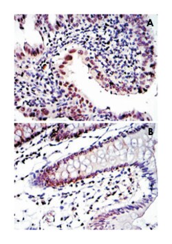 PSMB8, Mouse, Clone: 1A5, Abnova 100&mu;L; Unlabeled:Antibodies, Monoclonal