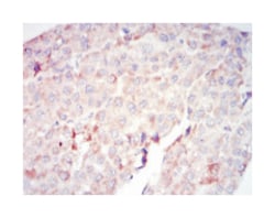 RAF1, Mouse, Clone: 4G4, Abnova 100&mu;L; Unlabeled:Antistoffer