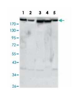 RICTOR, Mouse, Clone: 7B3, Abnova 100&mu;L; Unlabeled:Antibodies, Monoclonal