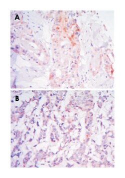 RICTOR, Mouse, Clone: 7B3, Abnova 100&mu;L; Unlabeled:Antibodies, Monoclonal