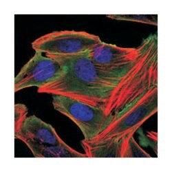 RPS6KA3, Mouse, Clone: 4E10, Abnova 100&mu;L; Unlabeled:Antibodies, Monoclonal