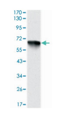 RPS6KA3, Mouse, Clone: 4E10, Abnova 100&mu;L; Unlabeled:Antibodies, Monoclonal