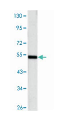Mouse anti-SHH, Clone: 8G3, Abnova 100&mu;L:Antibodies, Monoclonal