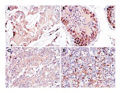 Mouse anti-SMN1, Clone: 5H1, Abnova 100&mu;L:Antibodies, Monoclonal