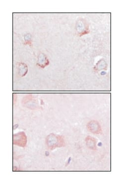 SORL1, Mouse, Clone: 3B6B11, Abnova 100&mu;L; Unlabeled:Antibodies, Monoclonal