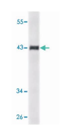 SORL1, Mouse, Clone: 3B6B11, Abnova 100&mu;L; Unlabeled:Antibodies, Monoclonal