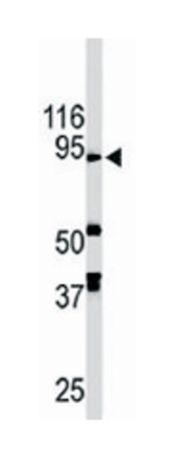 Aof 2 Rabbit anti-Human, Mouse, Polyclonal Antibody, Abnova 400&mu;L; Unlabeled:Antibodies,