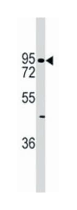 CDH6, Rabbit, Polyclonal Antibody, Abnova 400 &mu;L | Buy Online | Abnova | Fisher Scientific