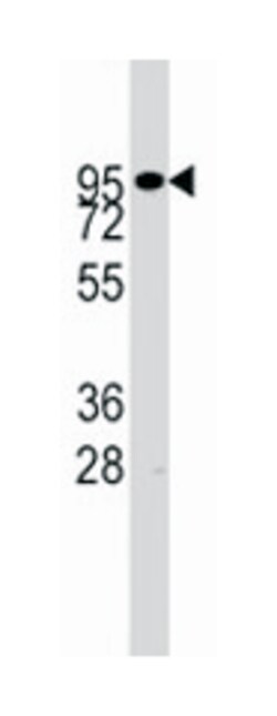 ADAM17 Rabbit anti-Human, Polyclonal Antibody, Abnova 400&mu;L; Unlabeled:Anticuerpos