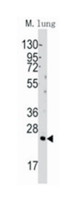 BID Rabbit anti-Human, Polyclonal Antibody, Abnova 400 &mu;L | Buy Online | Abnova Corporation | Fisher Scientific