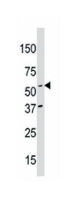 NAE1 Rabbit anti-Human, Polyclonal Antibody, Abnova 400 &mu;L | Buy Online | Abnova | Fisher Scientific