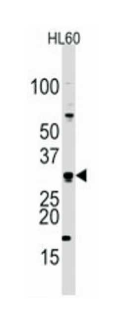 CDCA8 Rabbit anti-Human, Polyclonal Antibody, Abnova 400 &mu;L | Buy Online | Abnova Corporation | Fisher Scientific