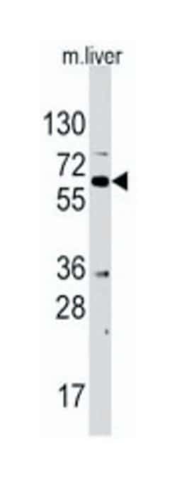 STK39 Rabbit anti-Human, Mouse, Polyclonal Antibody, Abnova 400&mu;L; Unlabeled:Antibodies,