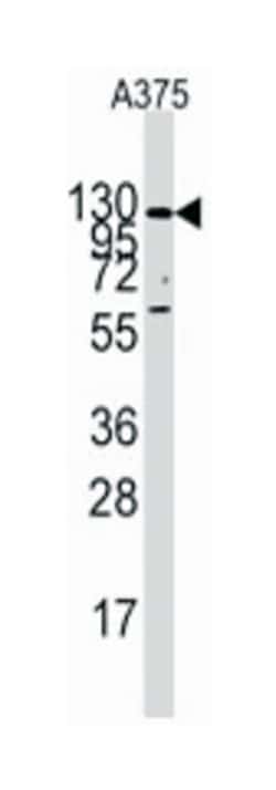 IDE, Rabbit, Polyclonal Antibody, Abnova 400&mu;L; Unlabeled:Antibodies,