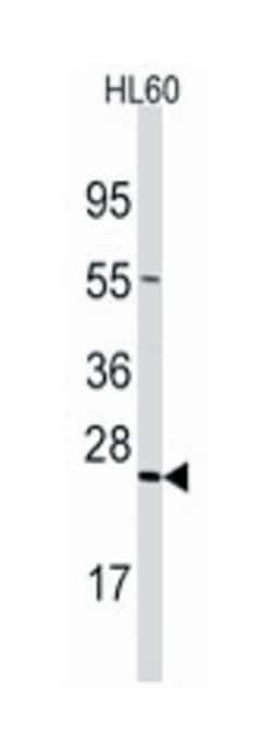 TRAPPC4, Rabbit, Polyclonal Antibody, Abnova 400&mu;L; Unlabeled:Antibodies,
