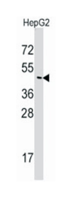 SNX6, Rabbit, Polyclonal Antibody, Abnova 400 &mu;L | Buy Online | Abnova Corporation | Fisher Scientific
