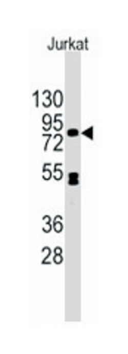 CDH12 Rabbit anti-Human, Polyclonal Antibody, Abnova 400μL; Unlabeled:Antibodies,