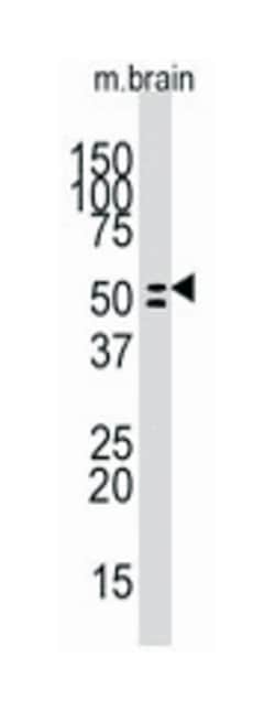 ALPL Rabbit anti-Human, Mouse, Polyclonal Antibody, Abnova 400 &mu;L | Buy Online | Abnova Corporation | Fisher Scientific