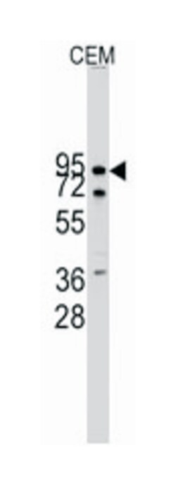 CDH10 Rabbit anti-Human, Polyclonal Antibody, Abnova 400 &mu;L | Buy Online | Abnova Corporation | Fisher Scientific