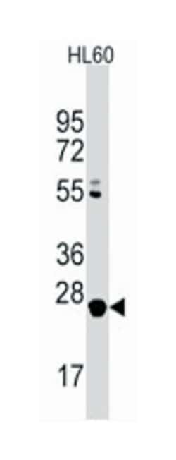 LIN28B Rabbit anti-Human, Polyclonal Antibody, Abnova 400 &mu;L | Buy Online | Abnova Corporation | Fisher Scientific