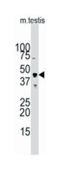 ACTB/ACTC1 Rabbit anti-Human, Mouse, Polyclonal Antibody, Abnova 400&mu;L;