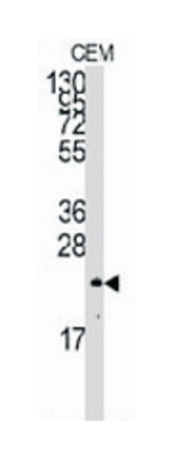 NRAS Rabbit anti-Human, Polyclonal Antibody, Abnova 400 &mu;L | Buy Online | Abnova Corporation | Fisher Scientific